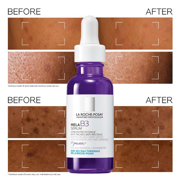 La Roche Posay Mela B3 Eye Cream 15ml