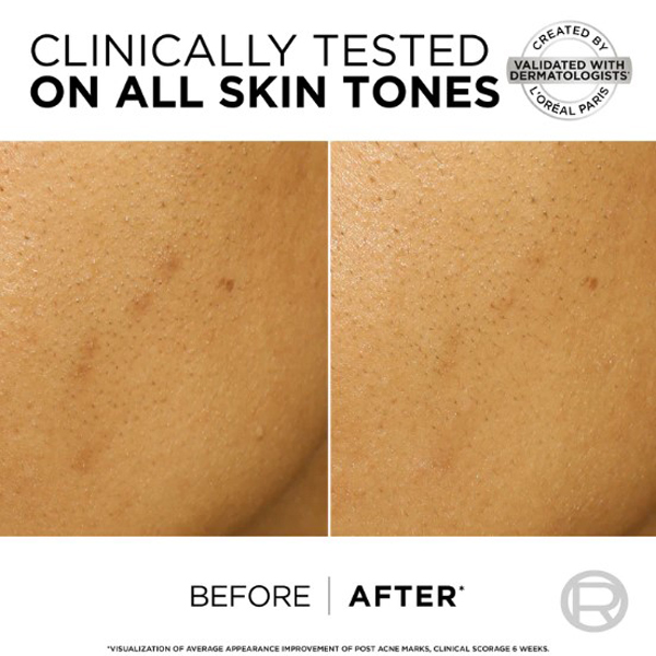 LOreal Bright Reveal Dark Spot Exfoliant Peel LOreal Bright Reveal Dark Spot Exfoliant Peel