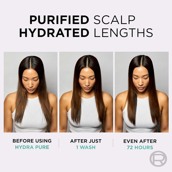 LOreal Elvive Hydra Pure Exfoliating Pre-Shampoo Scalp Serum for Oily Scalp & Roots 102ml LOreal Elvive Hydra Pure Exfoliating Pre-Shampoo Scalp Serum for Oily Scalp & Roots 102ml