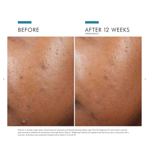 SkinCeuticals Phyto A+ Brightening Treatment 30ml