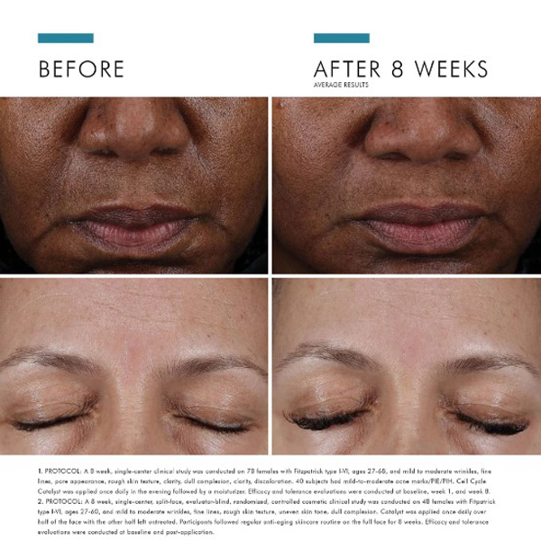 SkinCeuticals Cell Cycle Catalyst 30ml SkinCeuticals Cell Cycle Catalyst 30ml