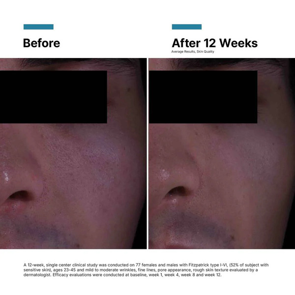 SkinCeuticals Anti Wrinkle P-Tiox Cream 48ml