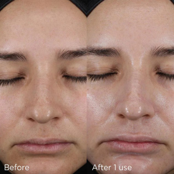 Image Skincare Sensitive Skin Sanctuary Bundle Image Skincare Sensitive Skin Sanctuary Bundle