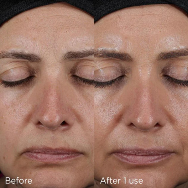 Image Skincare Brighten & Glow Bundle Image Skincare Brighten & Glow Bundle