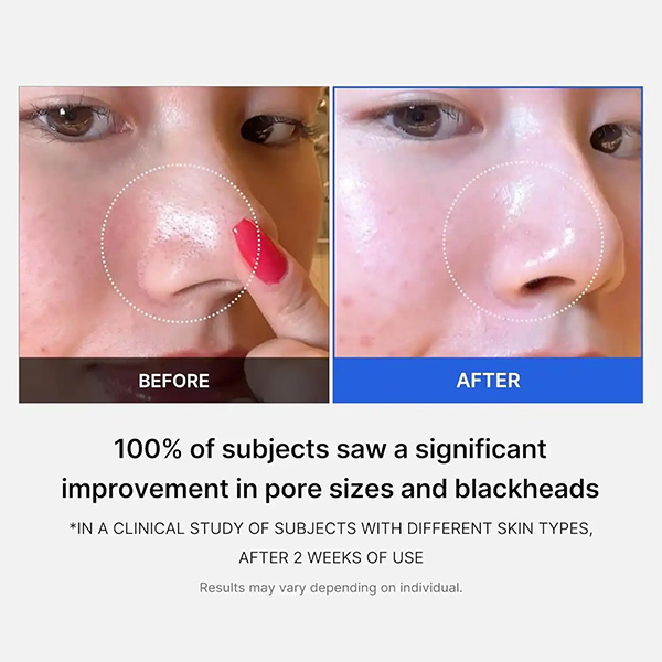 Medicube Zero Pore Pad 2.0 [70 Pads]